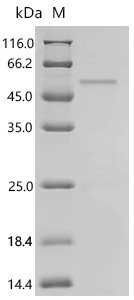 Human Homeobox protein Nkx-2.1 (NKX2-1) Recombinant Protein, Homo sapiens (Human), E.coli, C-terminal 6xHis-tagged, 44.6 kDa, purity >≥ 85% as determined by SDS-PAGE.