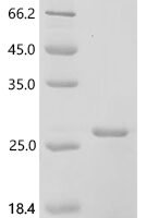 Human Interleukin-11 (IL11) Recombinant Protein, N-His - BioCrest Sci