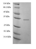 Human 52 kDa repressor of the inhibitor of the protein kinase (PRKRIR), partial Recombinant Protein, Homo sapiens (Human), E.coli, N-terminal 6xHis-SUMO-tagged, 33.6 kDa, purity >≥ 90% as determined by SDS-PAGE.