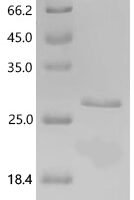 Chlamydia trachomatis serovar D Histone H1-like protein Hc1 (hctA) Recombinant Protein, C-His, aa 2–125, E.coli - BioCrest Sci