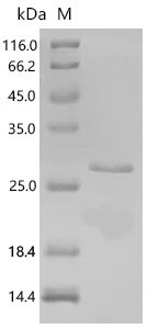 Chlamydia trachomatis serovar D Histone H1-like protein Hc1 (hctA) Recombinant Protein, C-His, aa 2–125, E.coli, Chlamydia trachomatis serovar D (strain ATCC VR-885 / DSM 19411 / UW-3/Cx), E.coli, C-terminal 6xHis-tagged, 20.5 kDa, purity >≥ 85% as determined by SDS-PAGE.