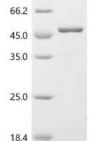 Human respiratory syncytial virus Protein M2-1 (M2-1) Recombinant Protein - BioCrest Sci