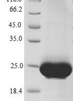 Human C-X-C chemokine receptor type 4 (CXCR4), partial Recombinant Protein - BioCrest Sci