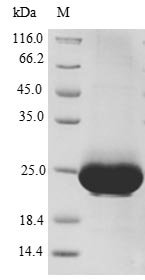 Human C-X-C chemokine receptor type 4 (CXCR4), partial Recombinant Protein, Homo sapiens (Human), E.coli, N-terminal 10xHis-SUMO-tagged and C-terminal Myc-tagged, 25.2 kDa, purity >≥ 90% as determined by SDS-PAGE.