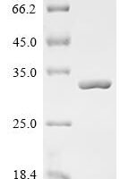 Lactobacillus casei 60 kDa chaperonin (groL), partial Recombinant Protein - BioCrest Sci