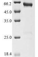 Human CD177 antigen (CD177),Partial Recombinant Protein - BioCrest Sci