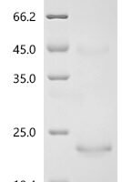 Bovine Cation-independent mannose-6-phosphate receptor(IGF2R), partial Recombinant Protein - BioCrest Sci