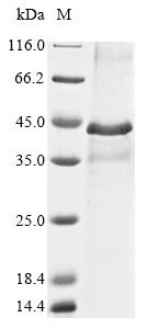 Mouse Proto-oncogene Wnt-1 (Wnt1) Recombinant Protein, Mus musculus (Mouse), E.coli, N-terminal 10xHis-tagged and C-terminal Myc-tagged, 45.8 kDa, purity >≥ 85% as determined by SDS-PAGE.
