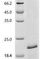 Rat Lutropin subunit beta (Lhb) Recombinant Protein - BioCrest Sci