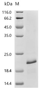 Rat Lutropin subunit beta (Lhb) Recombinant Protein, Rattus norvegicus (Rat), E.coli, C-terminal 6xHis-tagged, 19.8 kDa, purity >≥ 85% as determined by SDS-PAGE.