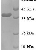 Human Tenascin (TNC), partial Recombinant Protein - BioCrest Sci