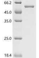 Norovirus Hu/GII.4/Sydney/NSW0514/2012/AU VP1, partial Recombinant Protein - BioCrest Sci