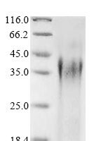 Candida albicans Candidapepsin-2 (SAP2) Recombinant Protein, N-His - BioCrest Sci