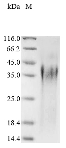 Candida albicans Candidapepsin-2 (SAP2) Recombinant Protein, N-His, Candida albicans (Yeast), Yeast, N-terminal 6xHis-tagged, 38.4 kDa, purity >≥ 90% as determined by SDS-PAGE.