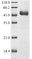 Human S-adenosylmethionine synthase isoform type-2 (MAT2A) Recombinant Protein, C-His - BioCrest Sci
