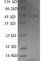 Mouse Fas apoptotic inhibitory molecule 3 (Fcmr), partial Recombinant Protein - BioCrest Sci