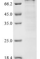 Human DNA polymerase theta (POLQ), partial Recombinant Protein, N-10His/C-Myc, aa 1792–2590 - BioCrest Sci