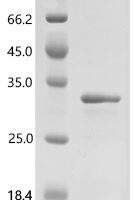 Human GTPase KRas (KRAS)(G12R), partial Recombinant Protein - BioCrest Sci