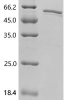Drosophila melanogaster S-adenosylmethionine synthase (Sams) Recombinant Protein, C-His, aa 1–408, E.coli - BioCrest Sci