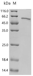 Drosophila melanogaster S-adenosylmethionine synthase (Sams) Recombinant Protein, C-His, aa 1–408, E.coli, Drosophila melanogaster (Fruit fly), E.coli, C-terminal 6xHis-tagged, 51.6 kDa, purity >≥ 90% as determined by SDS-PAGE.