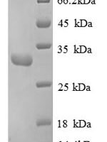 Human Replication protein A 30 kDa subunit (RPA4), partial Recombinant Protein - BioCrest Sci