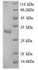 Human Replication protein A 30 kDa subunit (RPA4), partial Recombinant Protein, Homo sapiens (Human), E.coli, N-terminal 6xHis-tagged, 32.8 kDa, purity >≥ 90% as determined by SDS-PAGE.