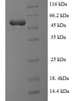Human TAR DNA-binding protein 43 (TARDBP), partial Recombinant Protein, N-His-SUMO - BioCrest Sci