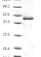 Human Thyroid hormone-inducible hepatic protein (THRSP) Recombinant Protein - BioCrest Sci