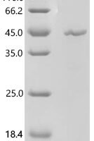 Pig Leptin (LEP) Recombinant Protein - BioCrest Sci