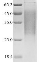 Human Gap junction alpha-1 protein (GJA1), partial Recombinant Protein - BioCrest Sci