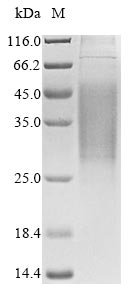 Human Gap junction alpha-1 protein (GJA1), partial Recombinant Protein, Homo sapiens (Human), Mammalian cell, N-terminal 10xHis-tagged, 19.9 kDa, purity >≥ 90% as determined by SDS-PAGE.