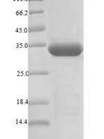 Pyrococcus furiosus Putative L-asparaginase (PF0142), partial Recombinant Protein - BioCrest Sci
