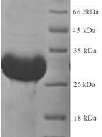 Rat Thyroxine 5-deiodinase (Dio3), partial (170:U→missing) Recombinant Protein, N-His, aa 63–304 (170:U→missing), Yeast - BioCrest Sci