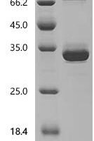 Mouse Endothelin-2 (Edn2), partial Recombinant Protein, N-hFc1 - BioCrest Sci