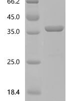 Escherichia coli Aminoglycoside (3'') (9) adenylyltransferase (aadA) Recombinant Protein, C-His - BioCrest Sci