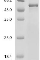 Human UDP-glucuronosyltransferase 1A5 (UGT1A5), partial Recombinant Protein - BioCrest Sci