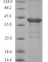 Human Dual specificity protein phosphatase 14 (DUSP14) Recombinant Protein - BioCrest Sci