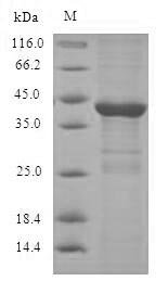 Human Dual specificity protein phosphatase 14 (DUSP14) Recombinant Protein, Homo sapiens (Human), E.coli, N-terminal 6xHis-SUMO-tagged, 38.3 kDa, purity >≥ 90% as determined by SDS-PAGE.