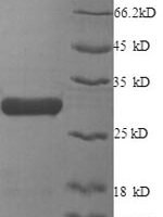 Human X-ray repair cross-complementing protein 6 (XRCC6), partial Recombinant Protein - BioCrest Sci