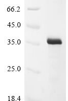 Vaccinia virus Soluble interferon gamma receptor OPG193 (OPG193) Recombinant Protein, N-10His/C-Myc - BioCrest Sci