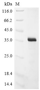 Vaccinia virus Soluble interferon gamma receptor OPG193 (OPG193) Recombinant Protein, N-10His/C-Myc, Vaccinia virus (strain Copenhagen) (VACV), E.coli, N-terminal 10xHis-tagged and C-terminal Myc-tagged, 34.6 kDa, purity >≥ 85% as determined by SDS-PAGE.