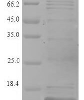 Dictyostelium discoideum Ponticulin (ponA) Recombinant Protein, N-His, aa 23–118, E.coli - BioCrest Sci