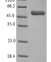 Clostridioides difficile NAD-specific glutamate dehydrogenase (gluD) Recombinant Protein, N-His - BioCrest Sci