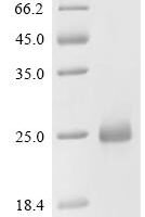 Human Collagen alpha-1 (IV) chain (COL4A1), partial Recombinant Protein, C-His - BioCrest Sci