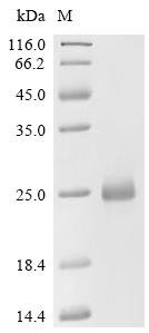 Human Collagen alpha-1 (IV) chain (COL4A1), partial Recombinant Protein, C-His, E.coli, C-terminal 6xHis-tagged, 19.8 kDa, purity >≥ 90% as determined by SDS-PAGE.