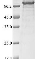 Mouse Transmembrane protease serine 6 (Tmprss6), partial Recombinant Protein - BioCrest Sci