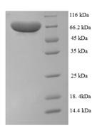 Human Protein-arginine deiminase type-1 (PADI1) Recombinant Protein, N-His, aa 1–663, E.coli - BioCrest Sci