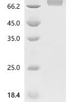 Human CD226 antigen (CD226), partial Recombinant Protein - BioCrest Sci