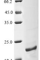 Rat D-dopachrome decarboxylase (Ddt) Recombinant Protein, N-10His/C-V5 - BioCrest Sci