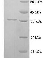 Rat Muscarinic acetylcholine receptor M1 (Chrm1), partial Recombinant Protein, N-His, aa 210–366, Yeast - BioCrest Sci